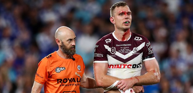 NRL Casualty Ward: Turbo shoulder scare; Bone bruising for Paps