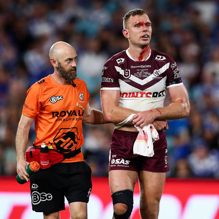 NRL Casualty Ward: Turbo shoulder scare; Bone bruising for Paps